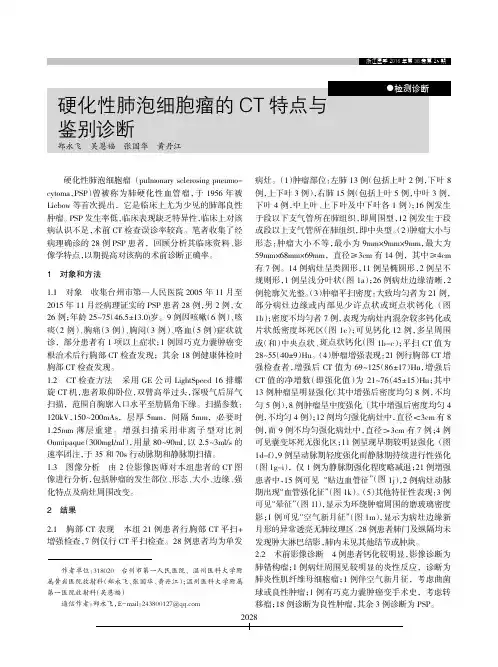 硬化性肺泡细胞瘤的CT特点与鉴别诊断