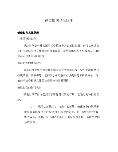碘造影剂显像原理