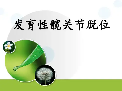发育性髋关节脱位ppt模板