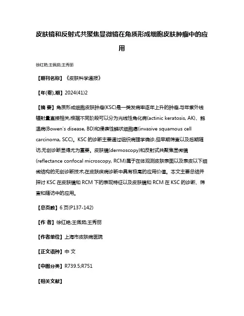 皮肤镜和反射式共聚焦显微镜在角质形成细胞皮肤肿瘤中的应用