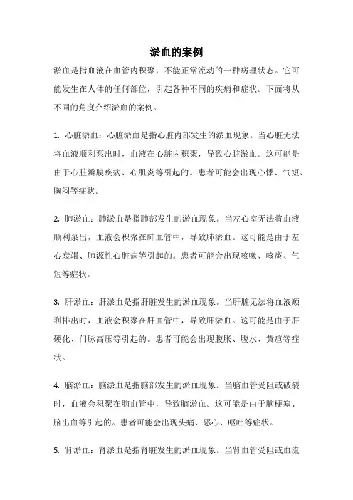 淤血的案例