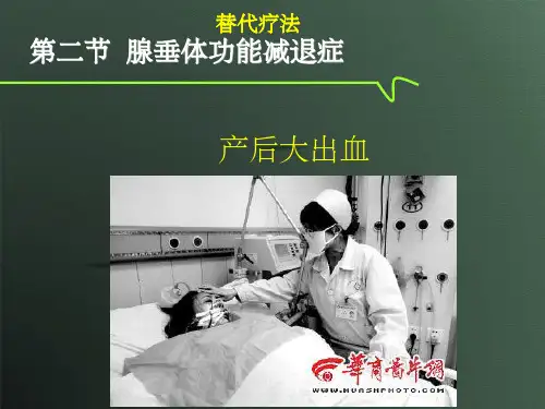 腺垂体功能减退症病人的护理ppt课件