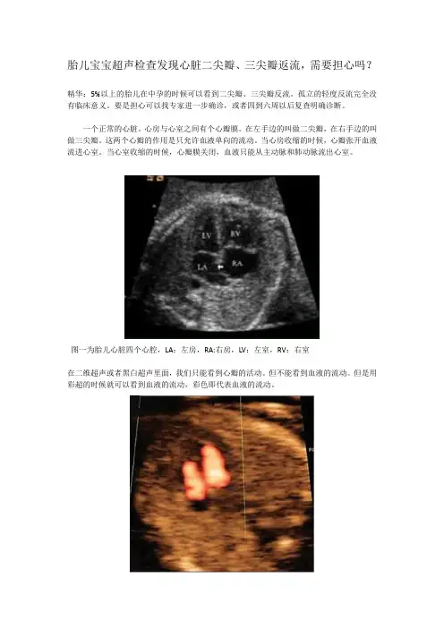 胎儿宝宝超声检查发现心脏二尖瓣、三尖瓣返流,需要担心吗？