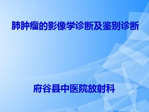【完整版】肺肿瘤影像学诊断PPT文档