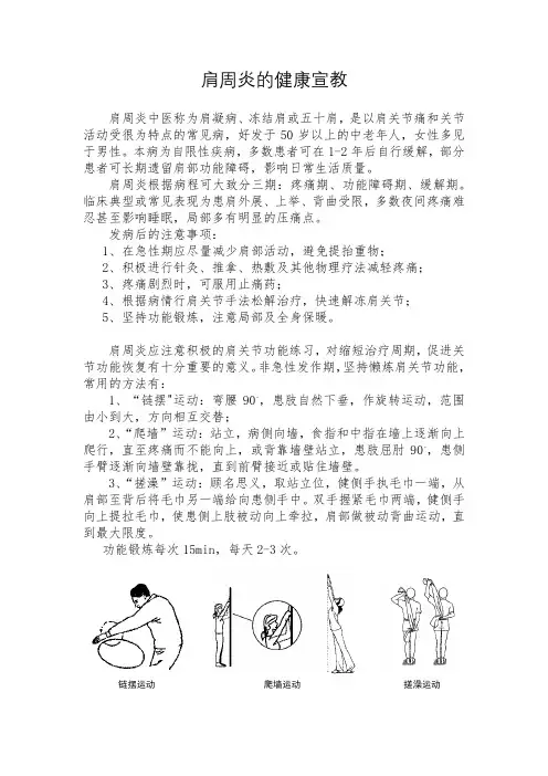 肩周炎的健康宣教