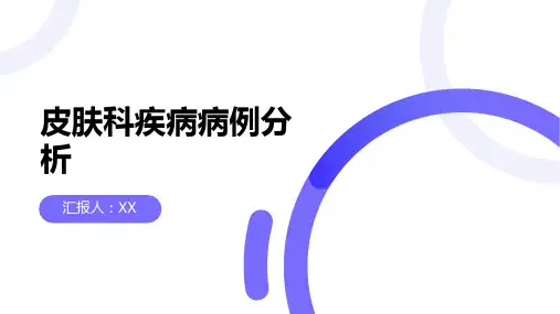 皮肤科疾病的病例分析
