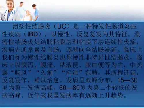 溃疡性结肠炎最新治疗