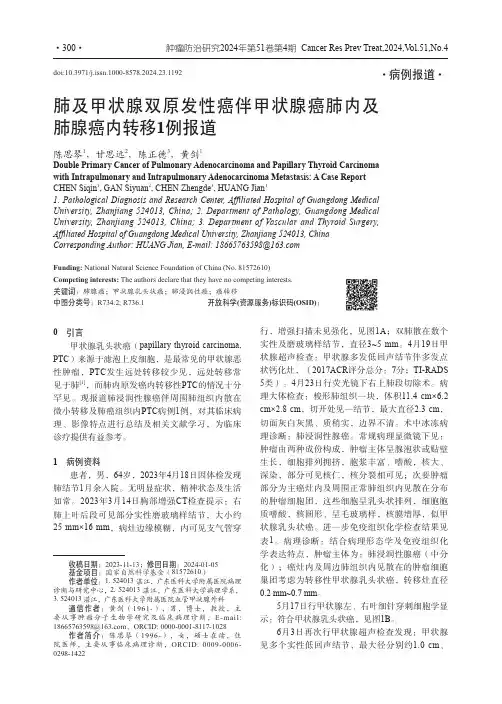 肺及甲状腺双原发性癌伴甲状腺癌肺内及肺腺癌内转移1例报道