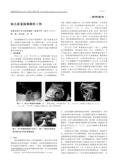 胎儿尿直肠隔畸形1例
