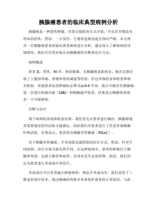 胰腺癌患者的临床典型病例分析
