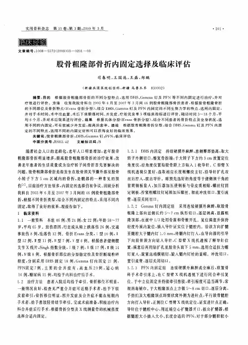 股骨粗隆部骨折内固定选择及临床评估