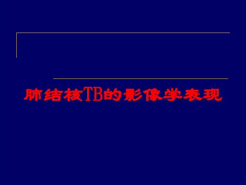 肺结核TB的影像学表现培训课件