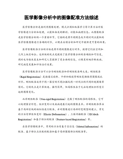 医学影像分析中的图像配准方法综述