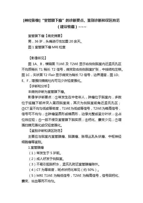 [神经影像]“室管膜下瘤”的诊断要点、鉴别诊断和误区防范（建议收藏）~~~