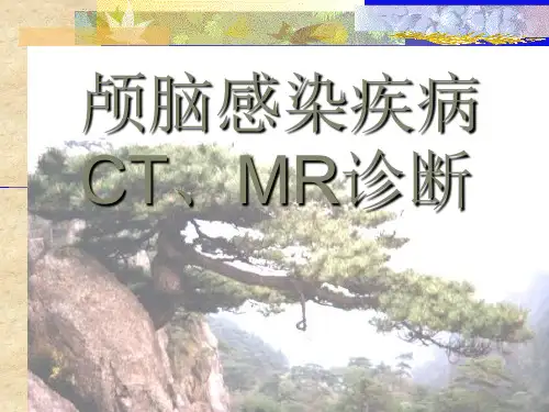 颅内感染的CT、MRI诊断