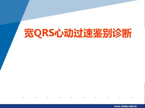 宽QRS心动过速鉴别诊断