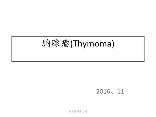 胸腺瘤影像表现 ppt课件
