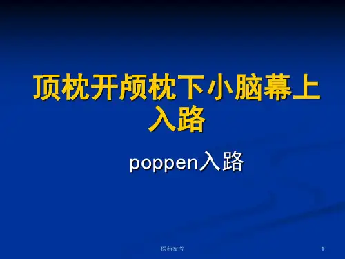 poppen入路(医药参考)