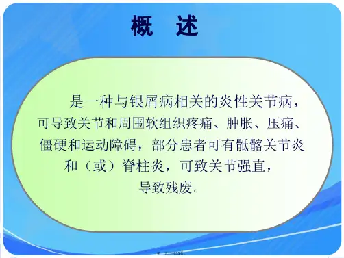 银屑病性关节炎