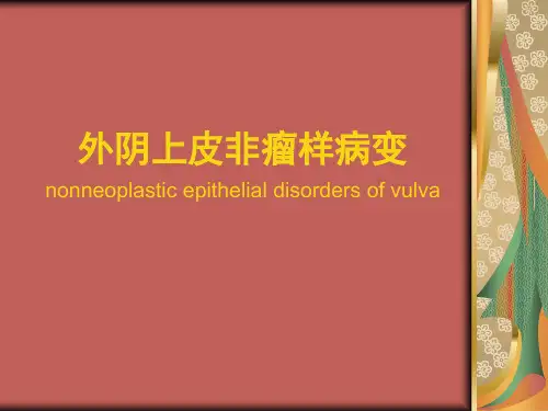 外阴上皮非瘤样病变PPT