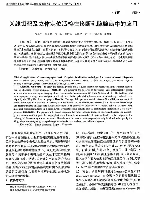 X线钼靶及立体定位活检在诊断乳腺腺病中的应用