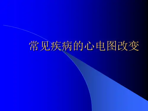 常见疾病的心电图改变