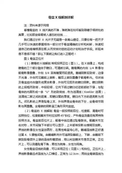 骨盆X线解剖详解