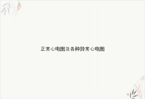 正常心电图及各种异常心电图PPT.