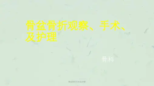 骨盆骨折手术及护理课件