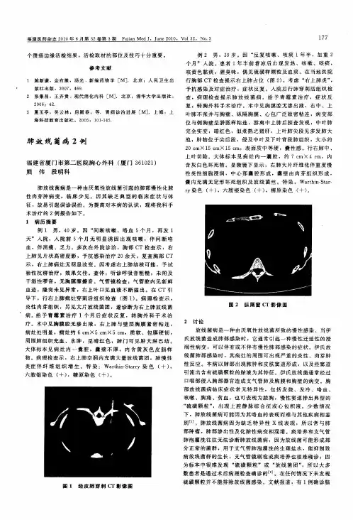 肺放线菌病2例