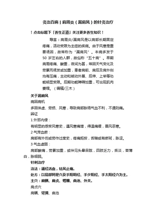 灸治百病丨肩周炎（漏肩风）的针灸治疗