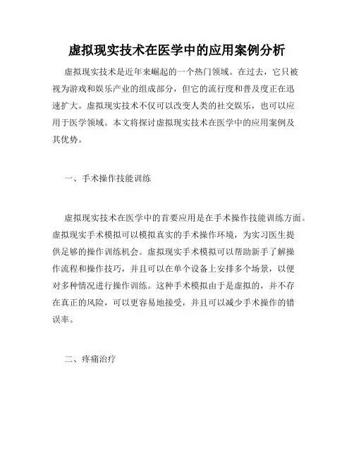 虚拟现实技术在医学中的应用案例分析