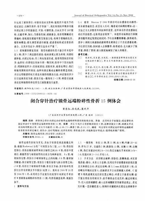 闭合穿针治疗锁骨远端粉碎性骨折15例体会