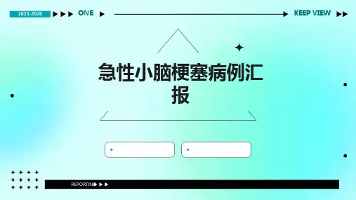 急性小脑梗塞病例汇报