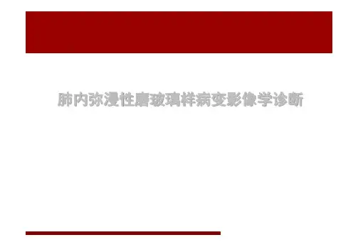 肺内弥漫性磨玻璃样病变影像学诊断PPT