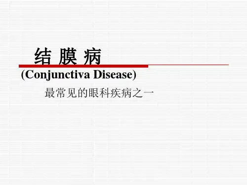 结膜病课件