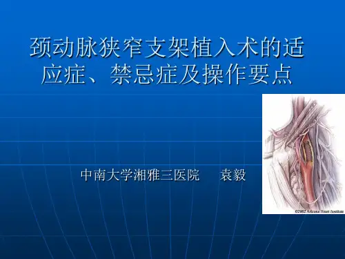 颈动脉支架的技术要点