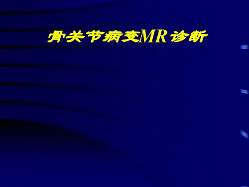 骨关节病变mr诊断课件