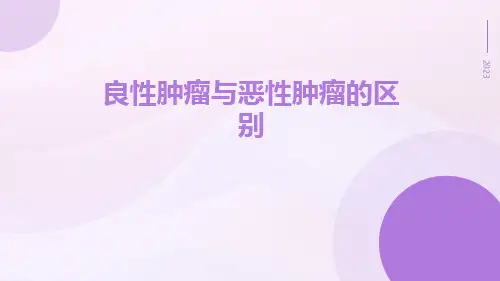 良性肿瘤与恶性肿瘤的区别