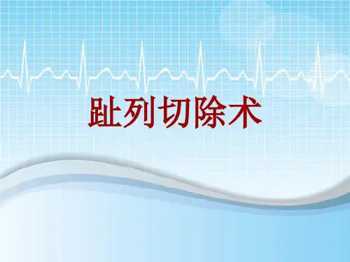 手术讲解模板：趾列切除术
