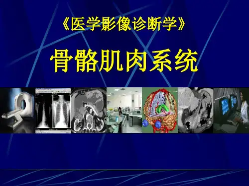 《医学影像诊断学》脊柱病变软组织病变PPT