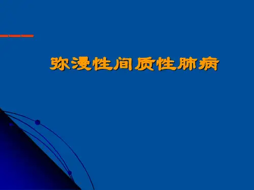 肺间质疾病PPT课件