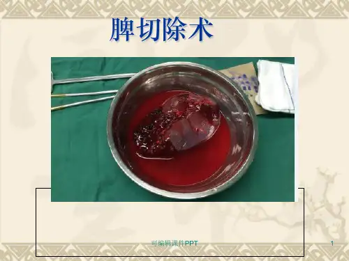 脾切除术ppt课件