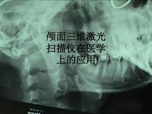 颅面三维激光扫描仪在医学上的应用ppt课件