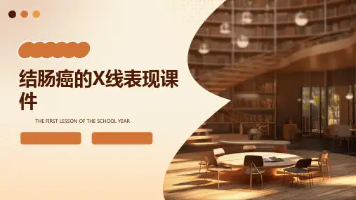 结肠癌的X线表现课件