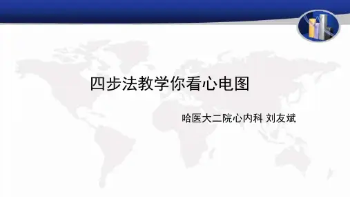 四步法教你学会看心电图