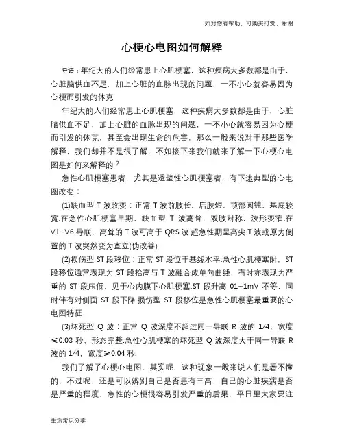 心梗心电图如何解释