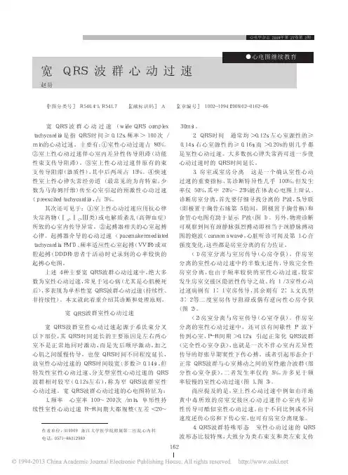 宽QRS波群心动过速_赵昜