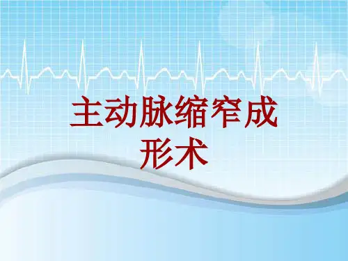 手术讲解模板：主动脉缩窄成形术