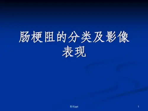 肠梗阻的分类及影像学表现